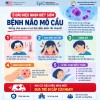 NÃO MÔ CẦU – NHẬN BIẾT SỚM, PHÒNG BỆNH KỊP THỜI